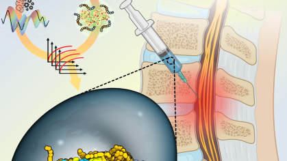 Illustration of a needle injecting cells into the spinal cord.